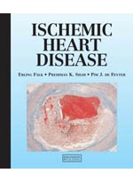 Ischemic Heart Disease