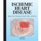 Ischemic Heart Disease