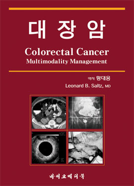 대장암:Colorectal Cancer