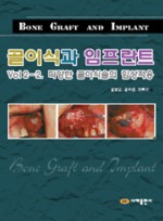 골이식과임프란트 Vol 2-2.다양한 골이식술의 임상적용