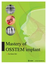 Mastery of OSSTEM implant