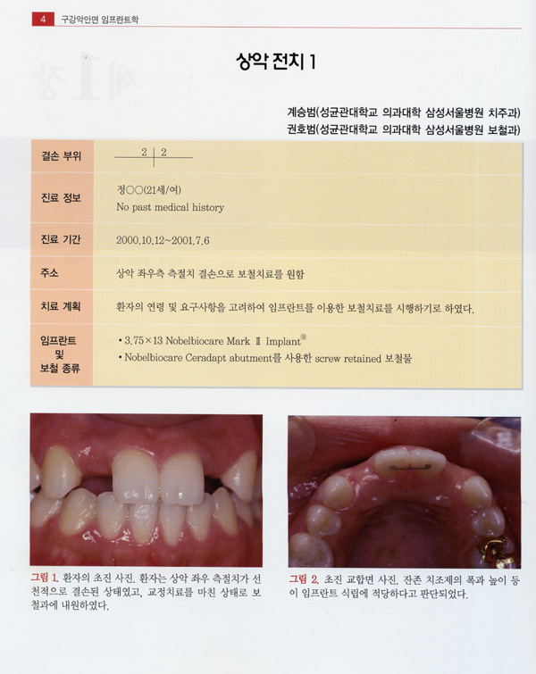 구강악안면 임프란트학 Vol.III