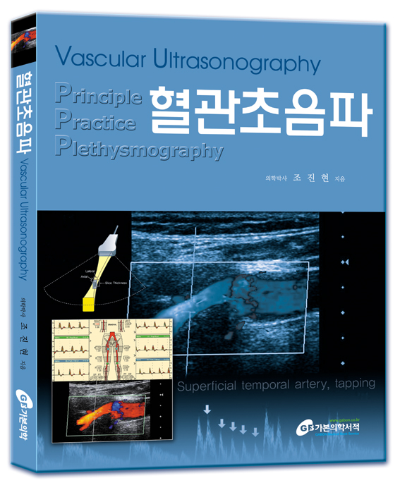혈관초음파-Vascular Ultrasonography