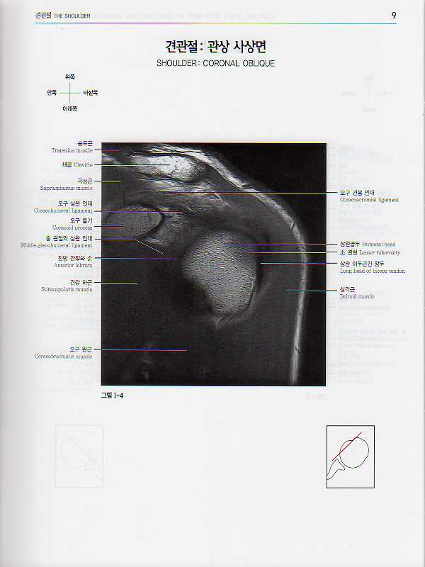 관절의 MRI, 관절경, 외과적 해부학