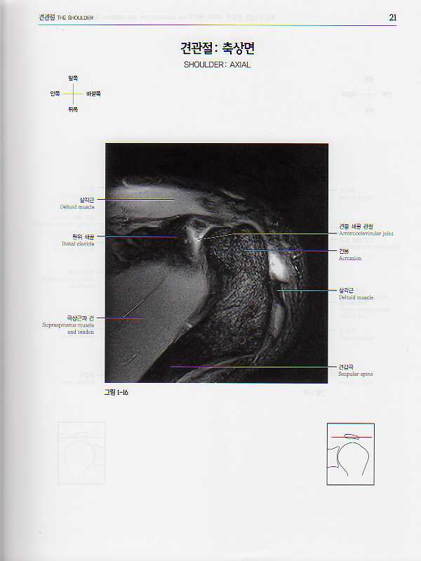 관절의 MRI, 관절경, 외과적 해부학