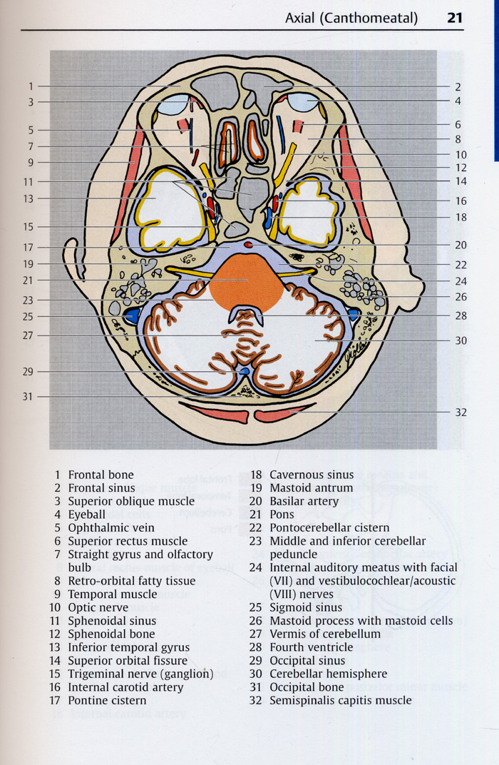 Pocket Atlas of Sectional AnatomyComputed Tomography and Magnetic Resonance Imaging Volume I: Head and Neck 3th