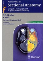 Pocket Atlas of Sectional AnatomyComputed Tomography and Magnetic Resonance Imaging Volume I: Head and Neck 3th