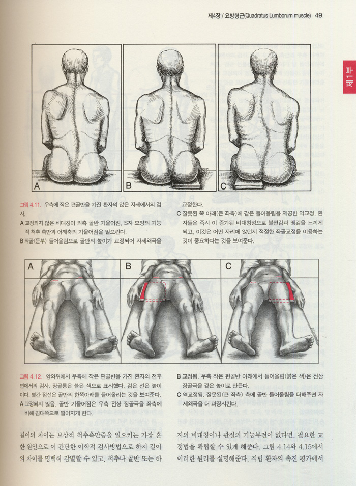 통증유발점의 기전과 치료- 제2권 하체 (트라벨.사이몬스)