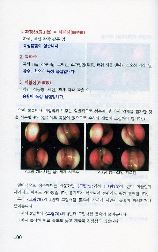 급만성 비강질환의 한의학적 최신지견