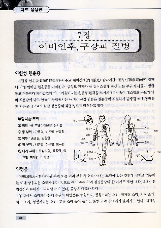 알기쉬운 부항요법