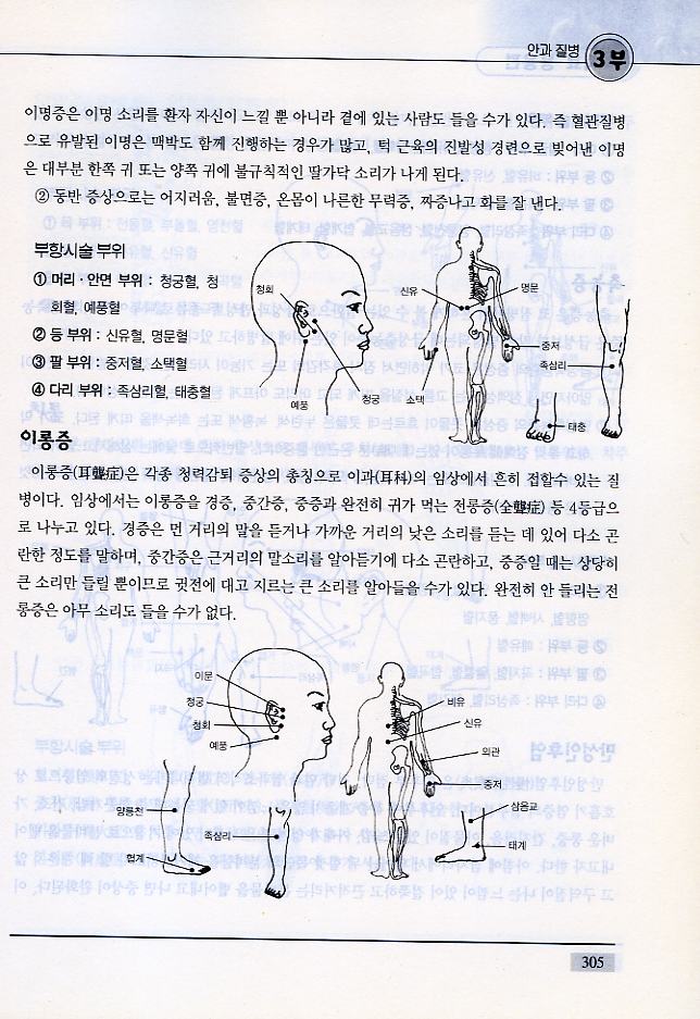 알기쉬운 부항요법