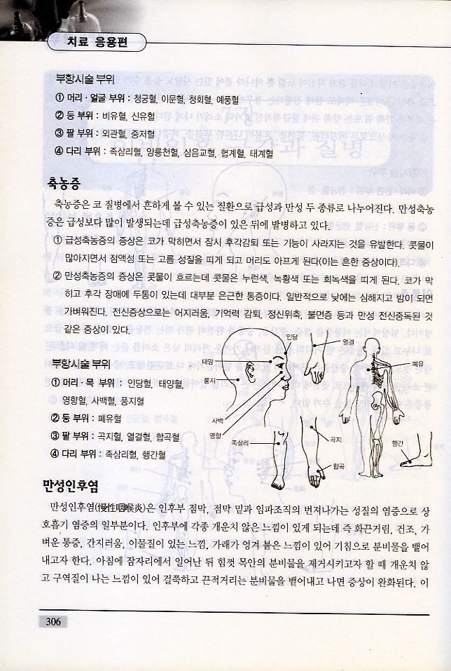 알기쉬운 부항요법