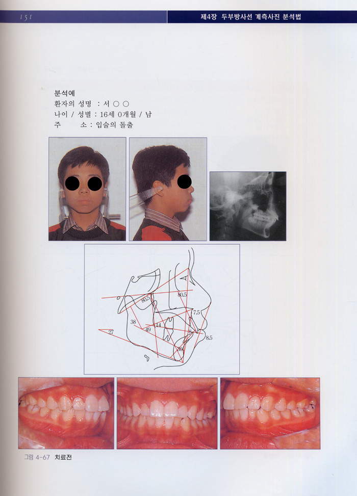 최신치과교정진단학