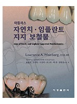 아틀라스 자연치 · 임플란트 지지 보철물