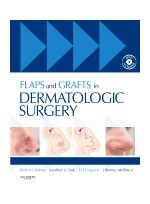 Flaps and Grafts in Dermatologic Surgery-Textbook with DVD