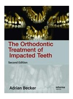 Orthodontic Treatment Impacted Teeth,2/e