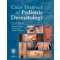 Color Textbook of Pediatric Dermatology,4/e - Text with CD-ROM