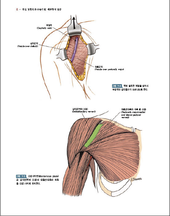 최신정형외과수술기법-해부학적접근:Surgical Exposures in Orthopaedics