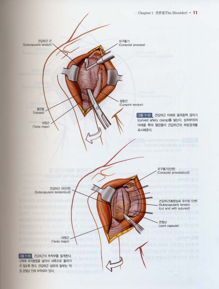 최신정형외과수술기법-해부학적접근:Surgical Exposures in Orthopaedics