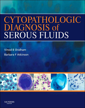 Cytopathologic Diagnosis of Serous Fluids