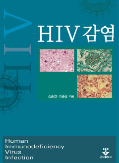 HIV감염