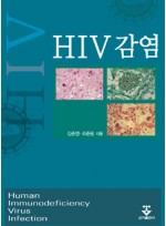 HIV감염