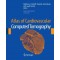 Atlas of Cardiovascular Computed Tomography