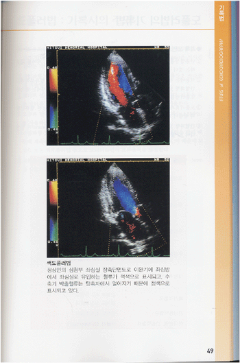 실전 심장초음파 아틀라스