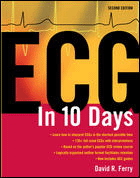 Electrocardiography in Ten Days 2/e