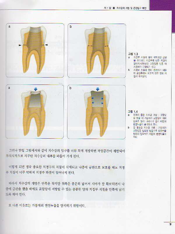 이승종의 도해로 보는 근관치료 아틀라스 (제3개정판)