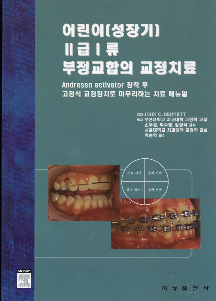 어린이(성장기) Ⅱ급Ⅰ류 부정교합의 교정치료