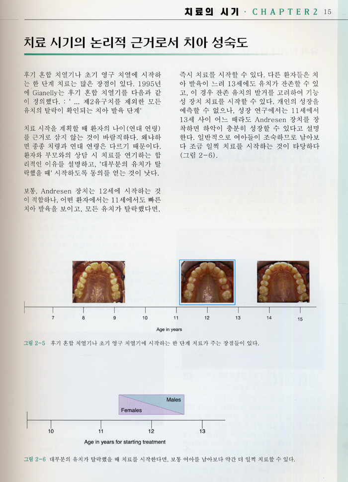 어린이(성장기) Ⅱ급Ⅰ류 부정교합의 교정치료