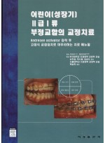 어린이(성장기) Ⅱ급Ⅰ류 부정교합의 교정치료