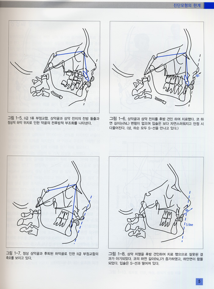 두부규격 방사선 계측학 - (CD 포함)