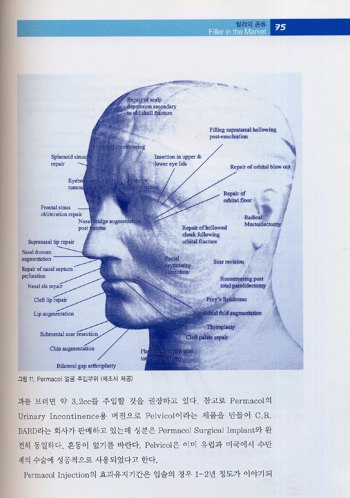 필러 바이블