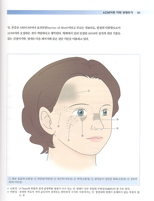 피부 반점 치료 클리닉