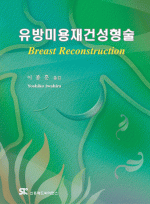 유방미용재건성형술(Breast Reconstruction)