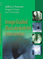 Image-Guided Musculoskeletal Intervention