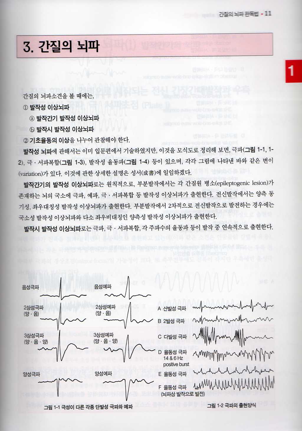 뇌파판독 step by step 제4판 (증례편)