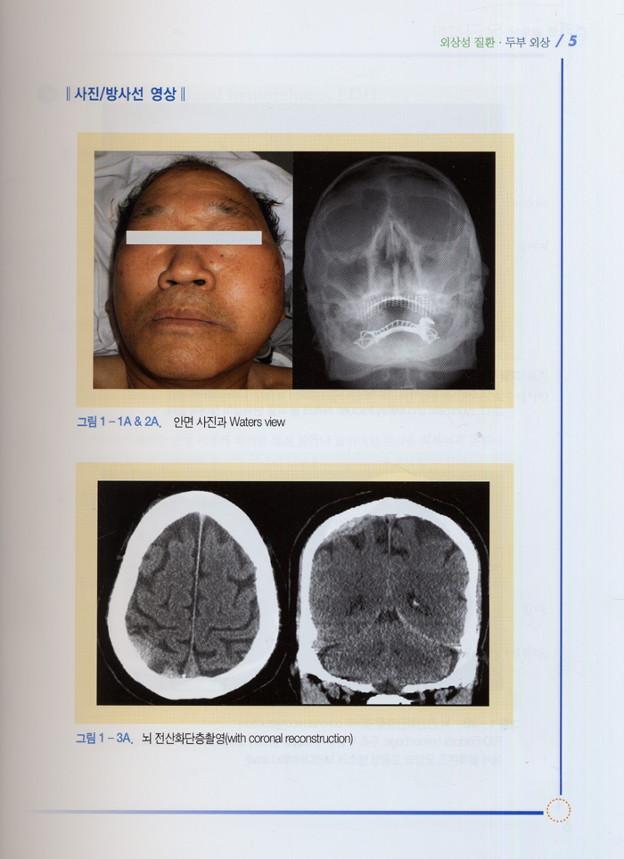 증례로 배우는 응급질환