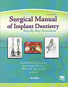 Surgical Manual of Implant Dentistry - Step-By-Step Procedures -