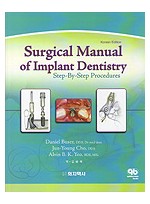 Surgical Manual of Implant Dentistry - Step-By-Step Procedures -