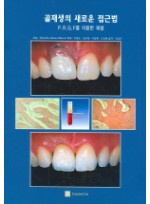 골재생의 새로운 접근법 (P.R.G.F를 이용한 재생)