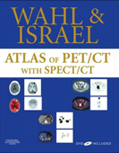 Atlas of PET/CT with SPECT/CT