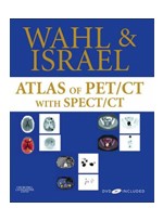 Atlas of PET/CT with SPECT/CT