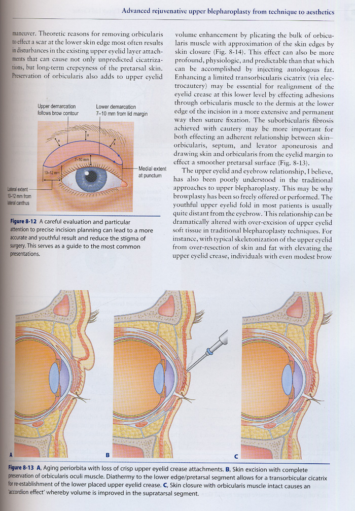 Putterman\'s Cosmetic Oculoplastic Surgery,4/e