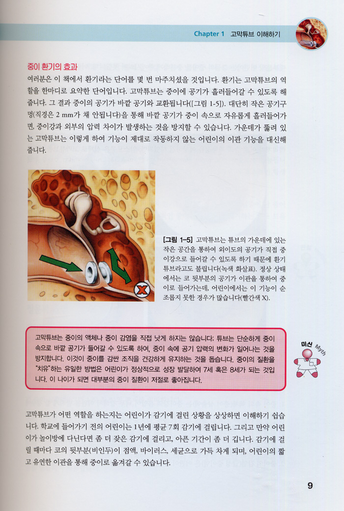 어린이 중이염과 고막튜브(A Parent's Guide to Ear Tubes)