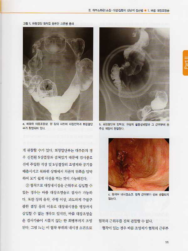 대장내시경 진단과치료