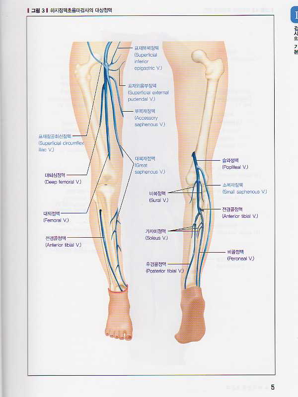 하지 정맥 초음파-쉽게 배울수 있는