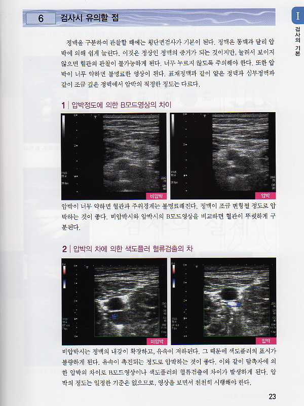 하지 정맥 초음파-쉽게 배울수 있는